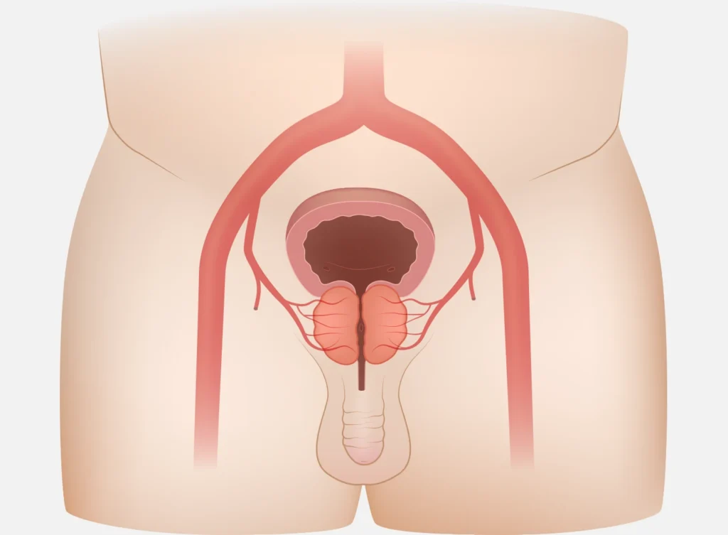 Pae Illustration Before