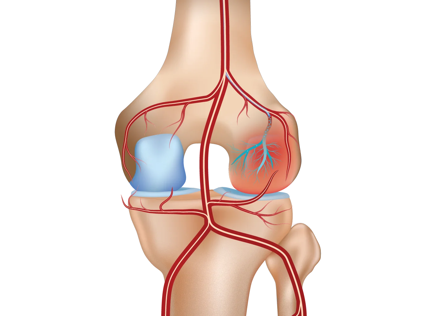 Knee Pain Gae Treatment After