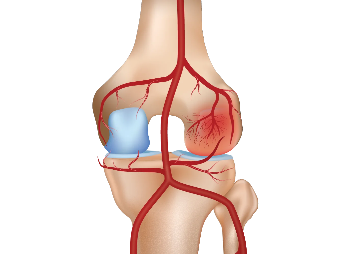 Knee Pain Gae Treatment Before